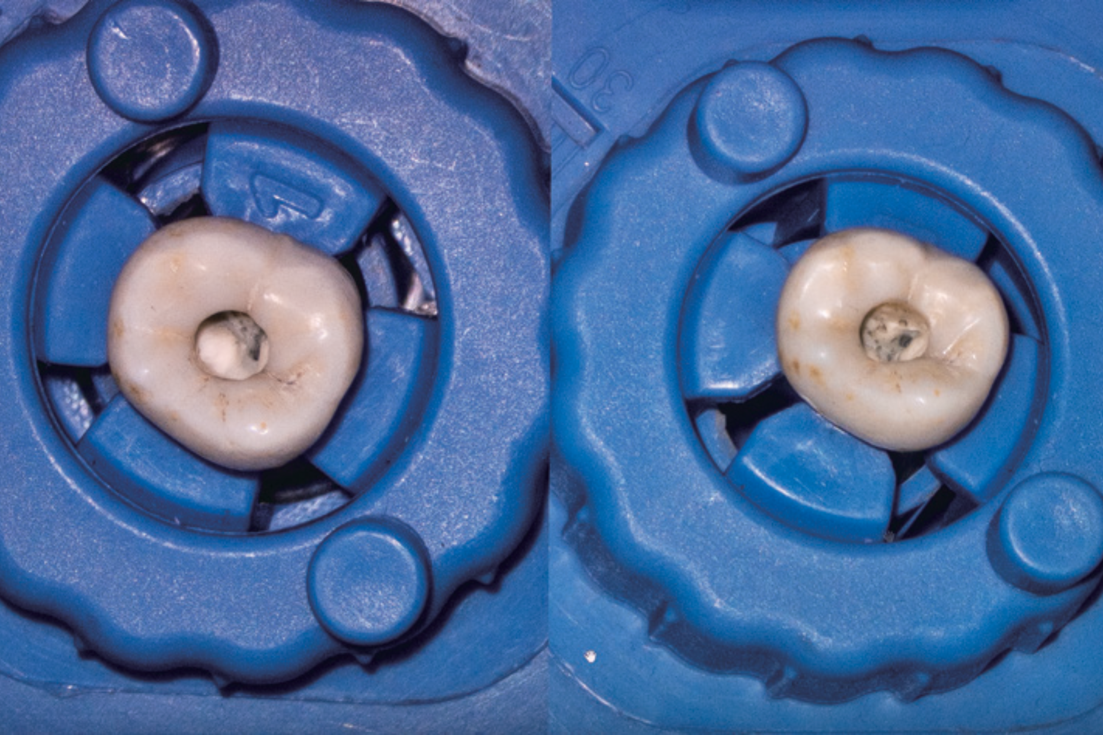 SM622 Dental Surgical Microscope