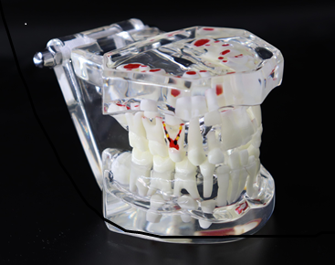 MODEL WITH MIX DENTITION