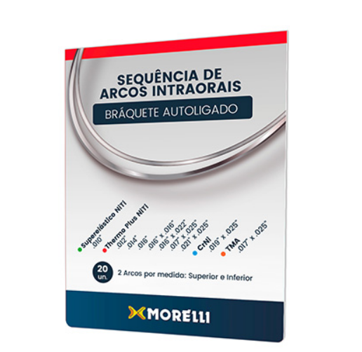 Self-Ligating Bracket Archwire Sequence