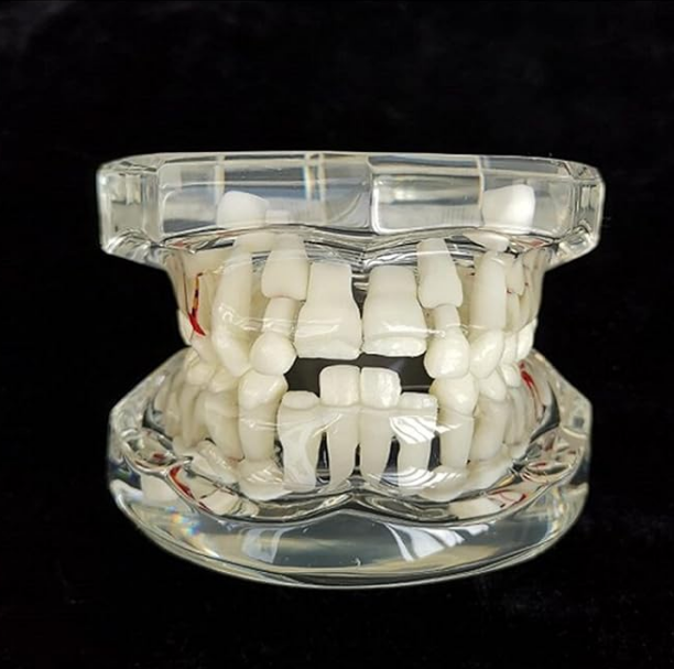 MODEL WITH MIX DENTITION