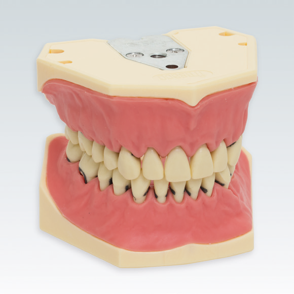 A-PZ Periodontitis Model