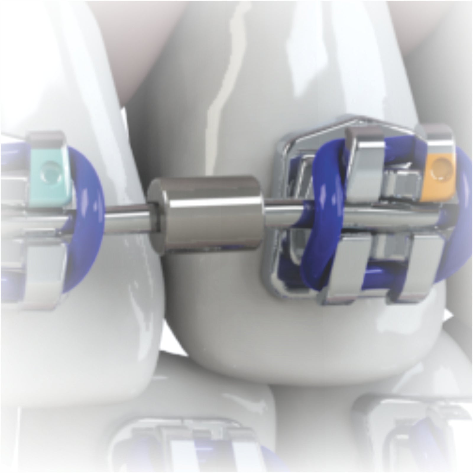 Stop For Wires Up to .022''