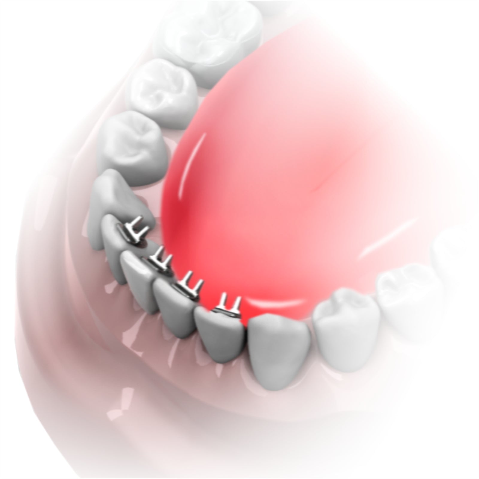 Mini Spur Tongue Educator