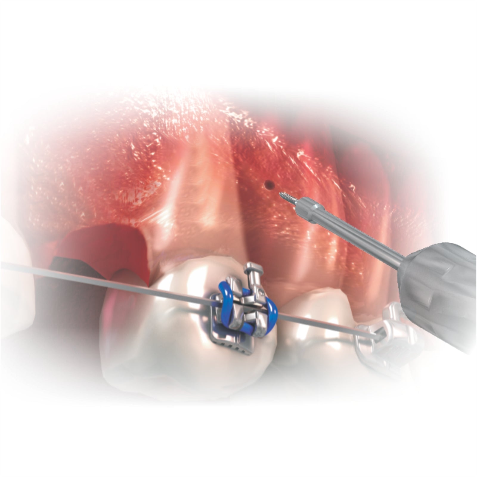 Hexagonal Key - Long & Short Stem