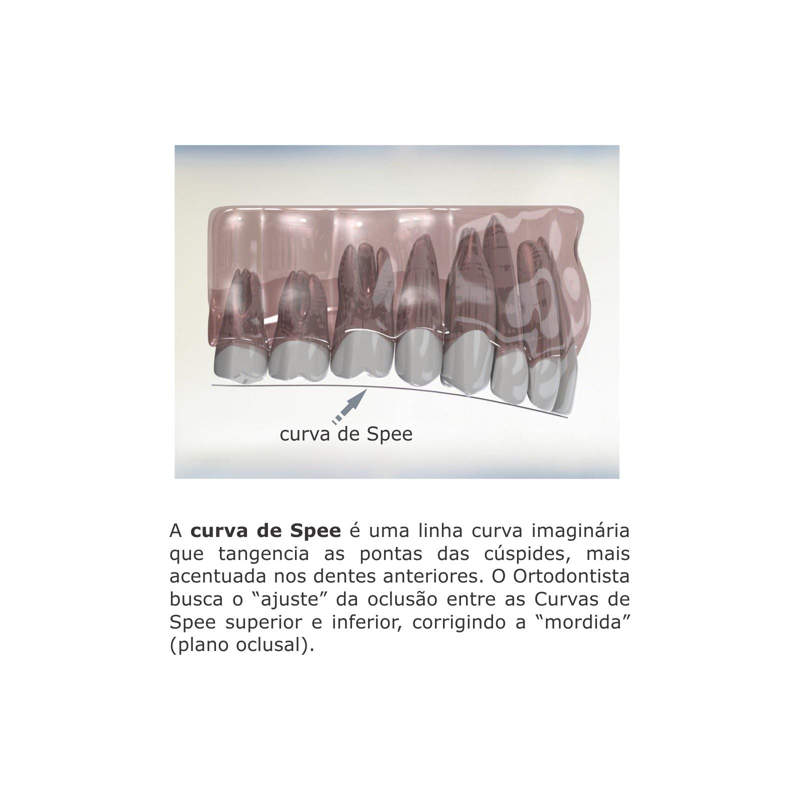 Intraoral Archwire Reverse Curve Superelastic NiTi Round