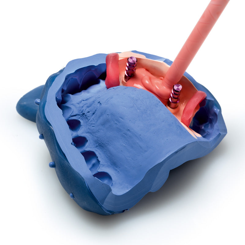 Gingifast Rigid - A-Silicone for gingival reproduction