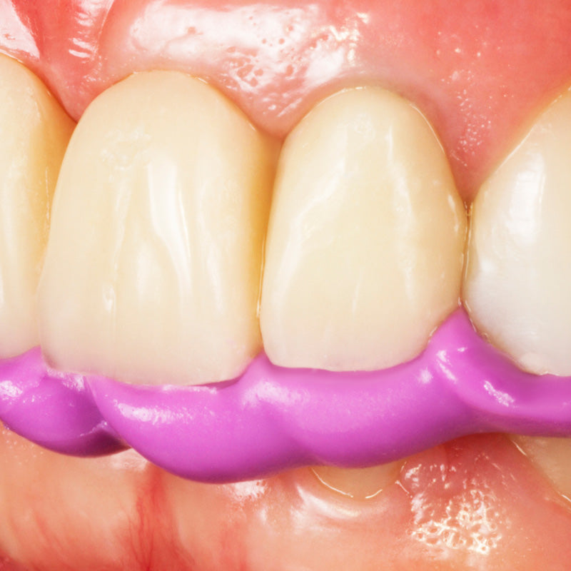 Occlufast Rock - Bite Registration A-Silicone