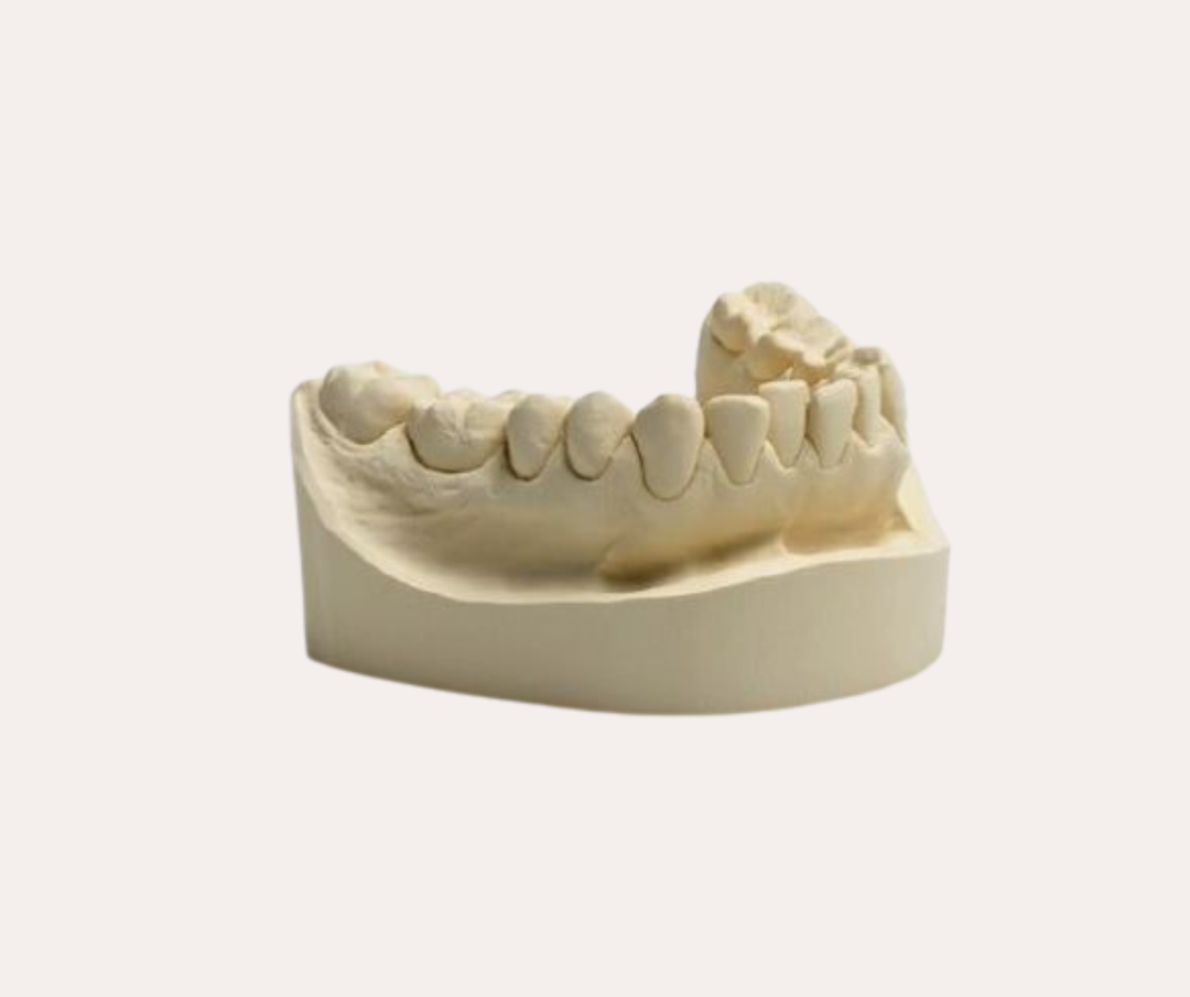 Elite Model Fast - Type 3 Fast Dental Stone