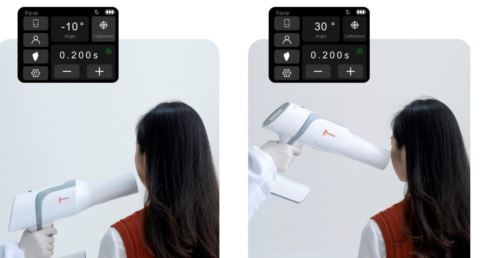 Ai Ray - Portable Intraoral X-Ray Machine