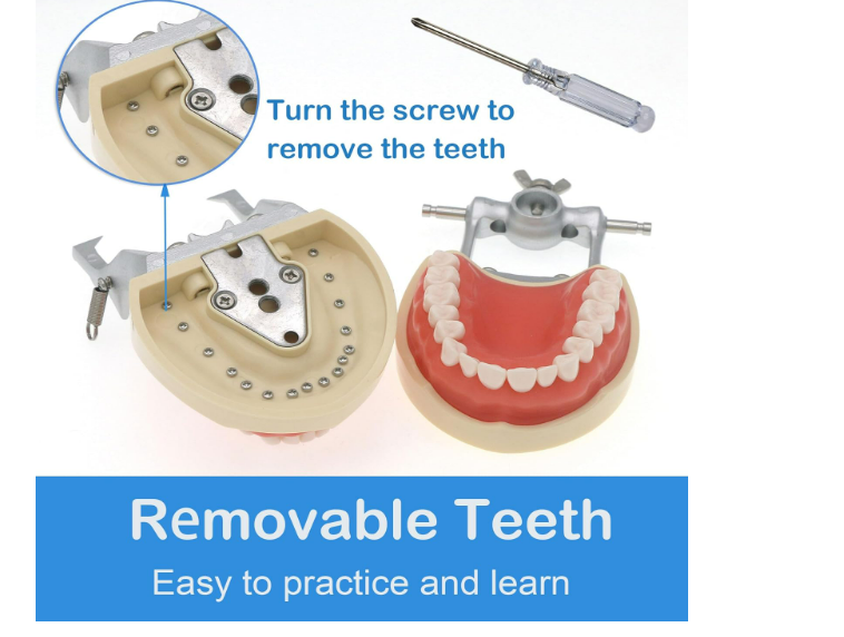 Standard Permanent Replaceable Teeth Model- 32 Screw-In Teeth Nissin Type-Soft Gum
