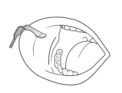 Retractors Tissue- Obwegeser External