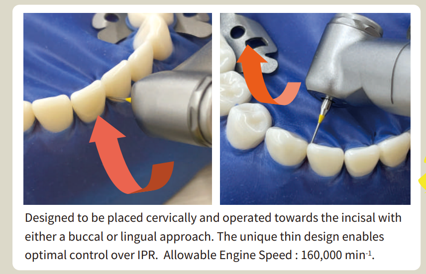 Mani Diamond Bur IPR-01EF- Inter proximal Reduction
