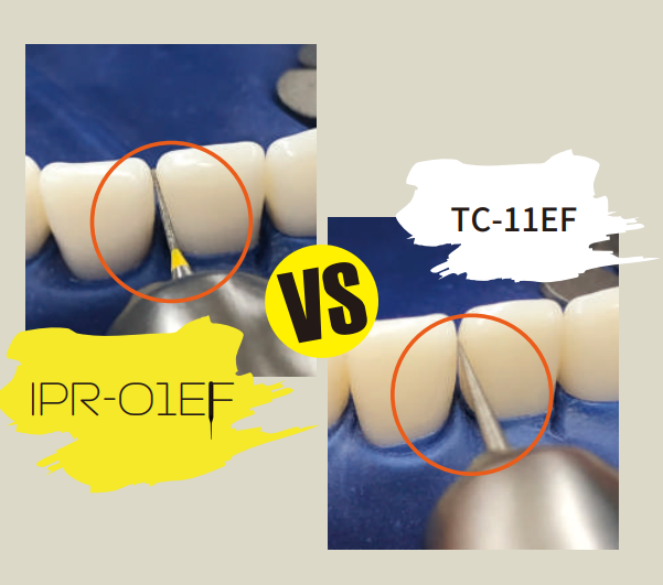 Mani Diamond Bur IPR-01EF- Inter proximal Reduction