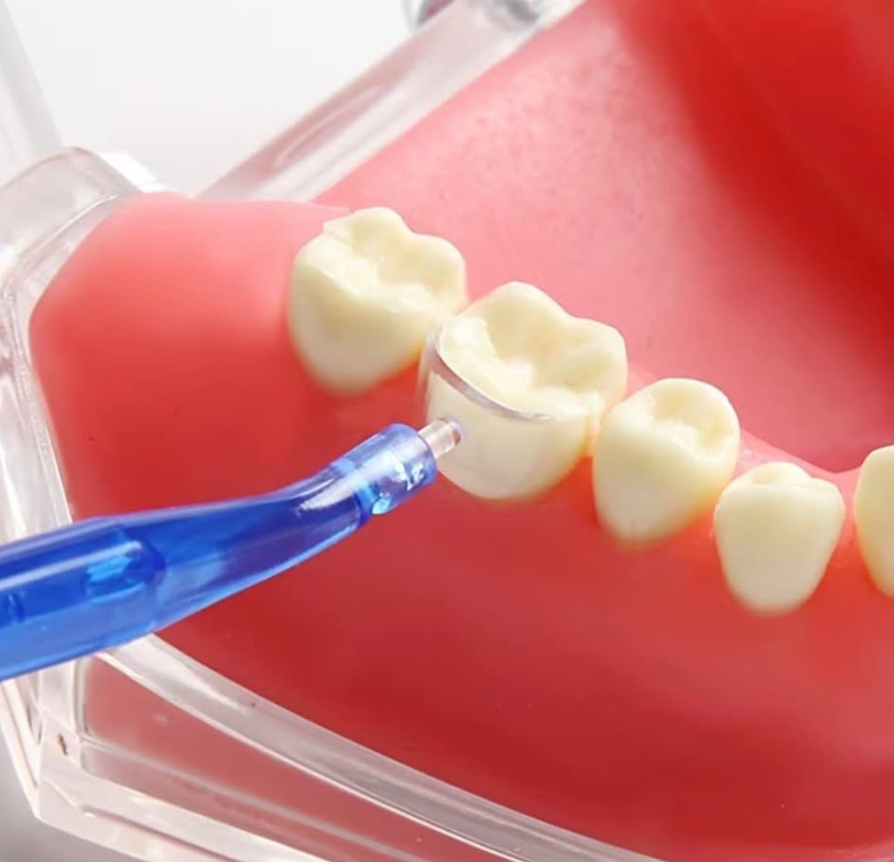 Transparent Cervical Matrix Kit