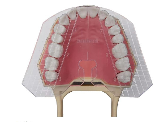 Guide Plate Upper Dental Guide Plate