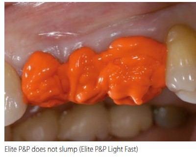 Elite P&P Light Body - Low viscosity A-Silicone