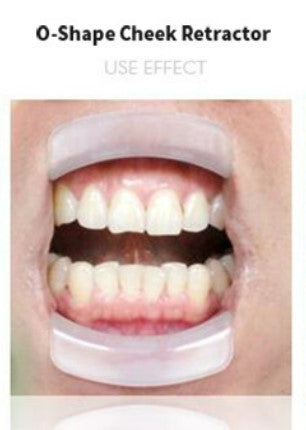 Cheek Retractors -  (O - Shape)