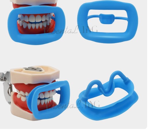 Cheek Retractor Mouth Opener