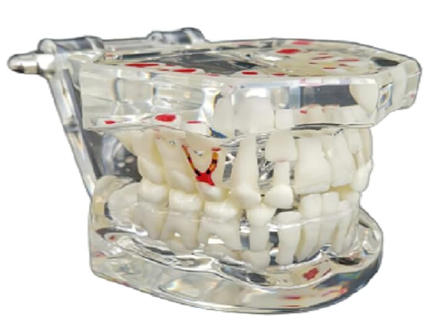 MODEL WITH MIX DENTITION