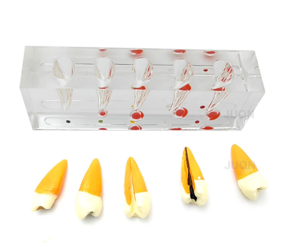 Endodontic Treatment Tooth Model For Dentistry Lab & Patient Education