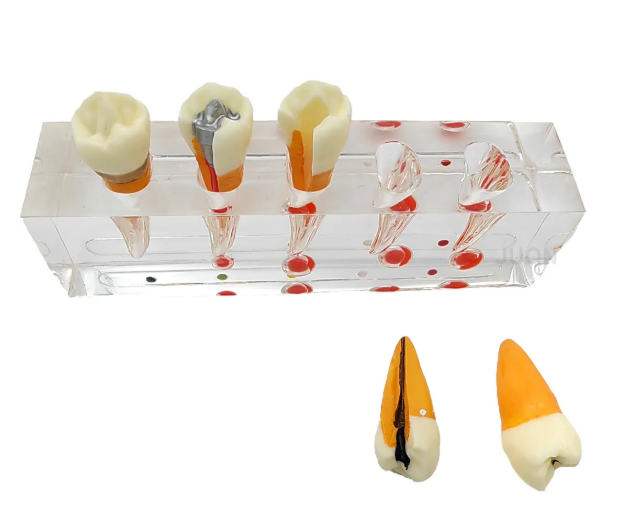 Endodontic Treatment Tooth Model For Dentistry Lab & Patient Education
