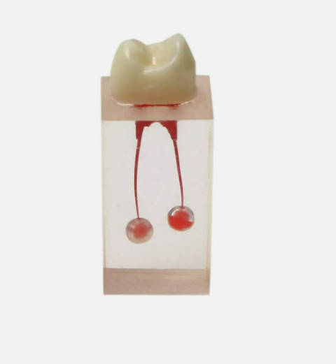 Root Canal Treatment Tooth Training Block Model