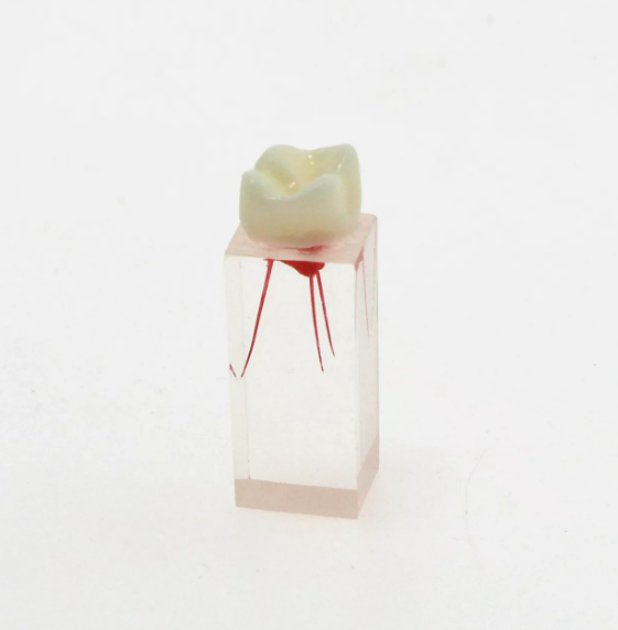 Root Canal Treatment Tooth Training Block Model