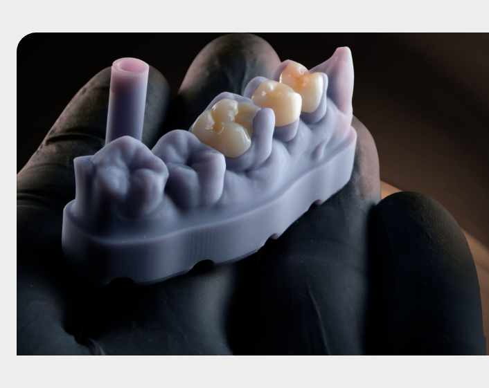 Voxelprint Ceramic - Resin For 3D Printing