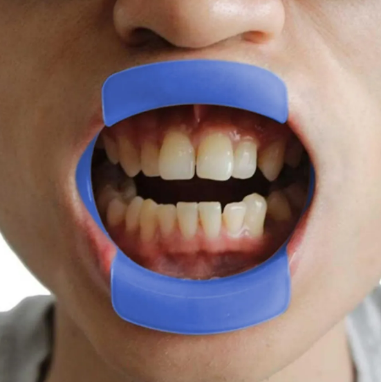 Cheek retractor- (o-type)