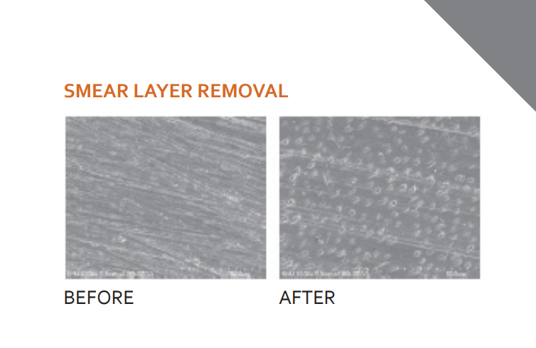 DiaPrep Pro - EDTA Root Canal Preparation Cream