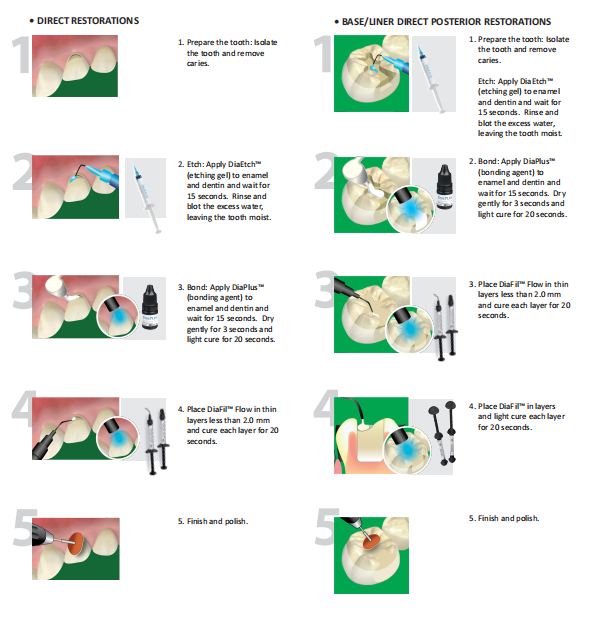 Diafil flow - Light Cured Flowable Restorative Composite Resin