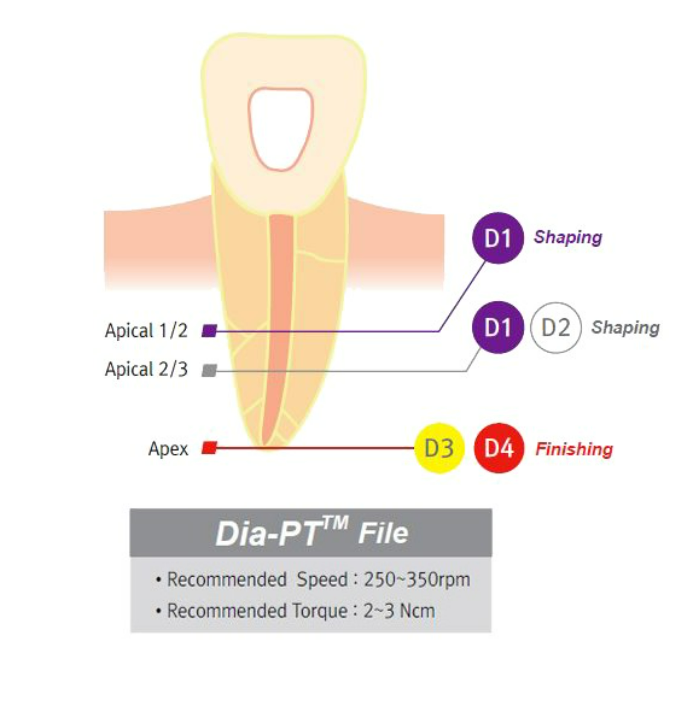 Dia-PT file - nickel titanium rotary files
