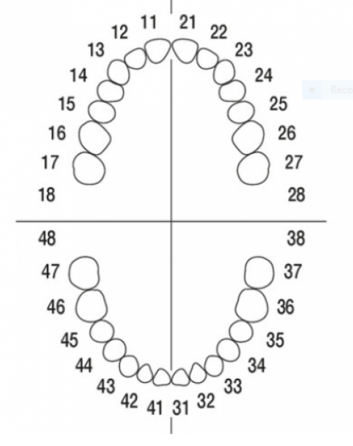 Teeth Model Replacement with Screws for AG-3 Dental Model