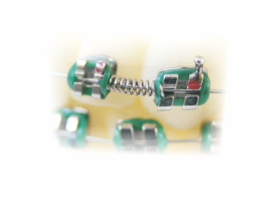 Orthodontic Spring CrNi