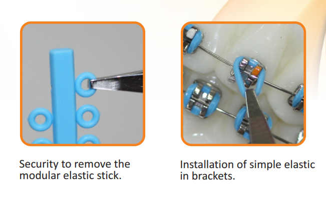 Elastic Separator