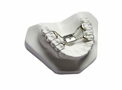 Hyrax Expansion Screw Palatal Split