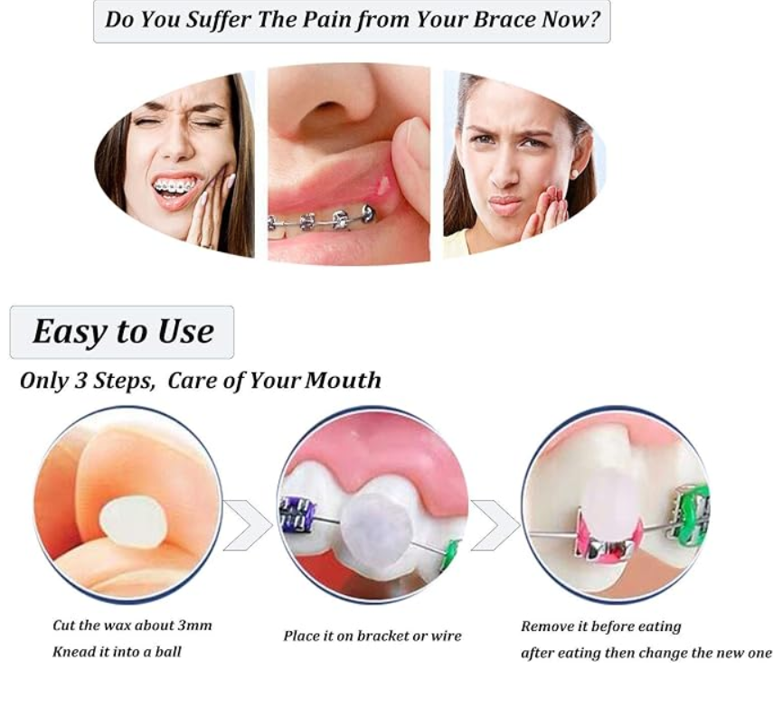 Orthodontic Protective Wax for Braces- 5 White Sticks/Box