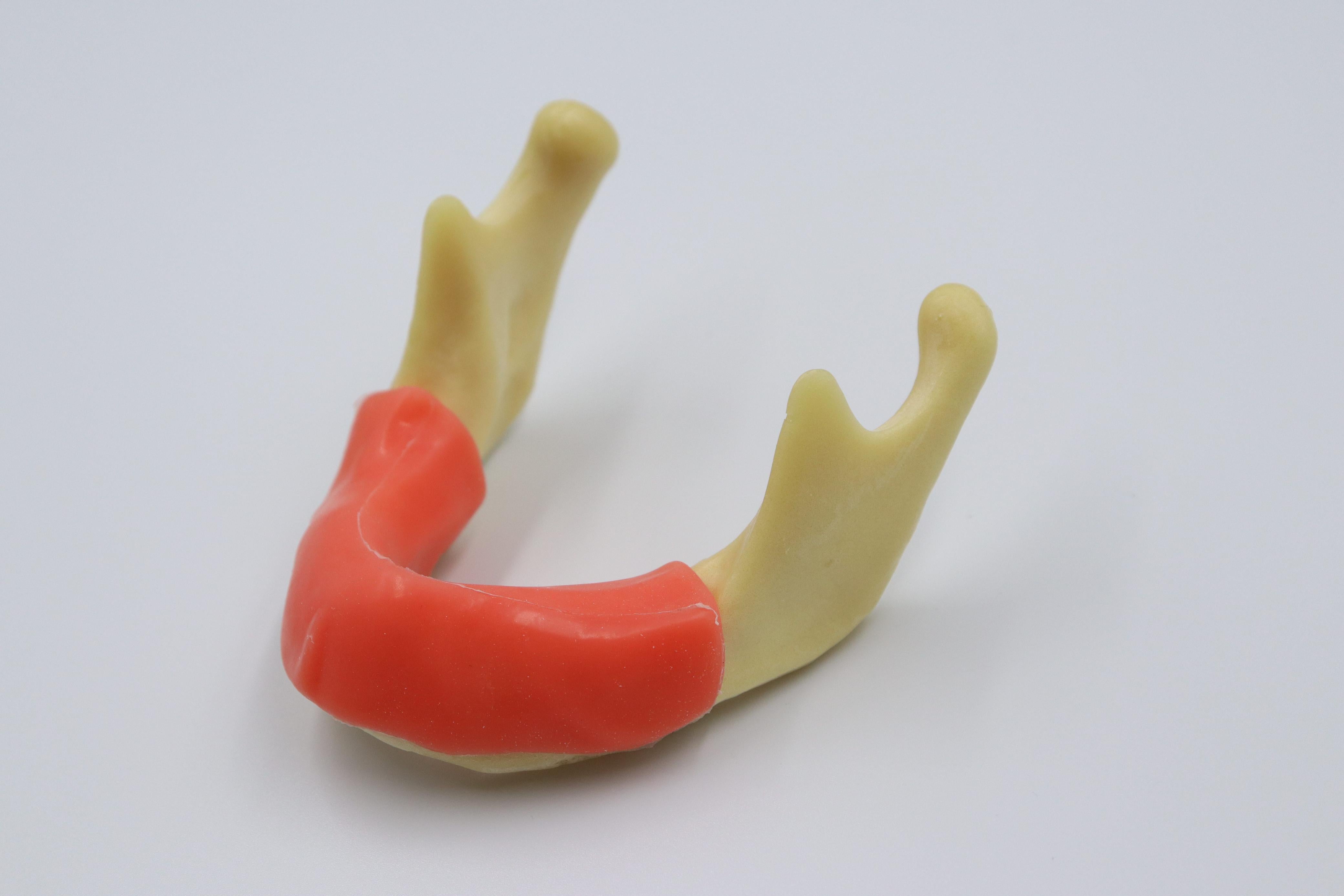 Dental Mandible Jaw Gum Model Implant Basic Drilling Insertion Practice