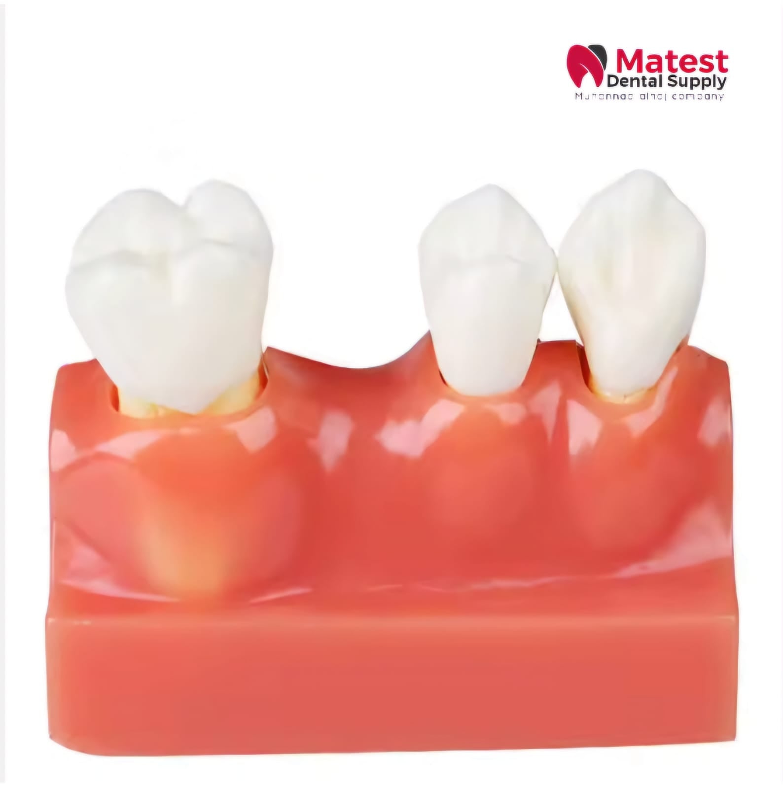 4 Times Dental Model Endodontics Anatomy Model for Dentist