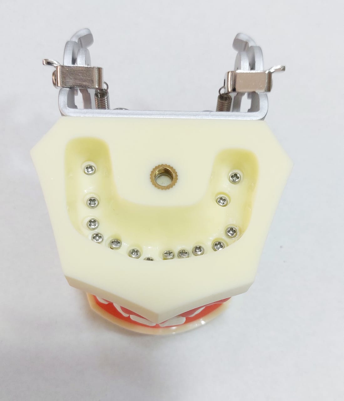 Jaw Model with Periodontal Disease