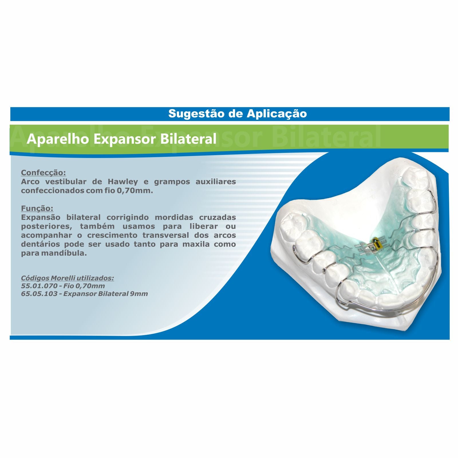 Expansion Screw