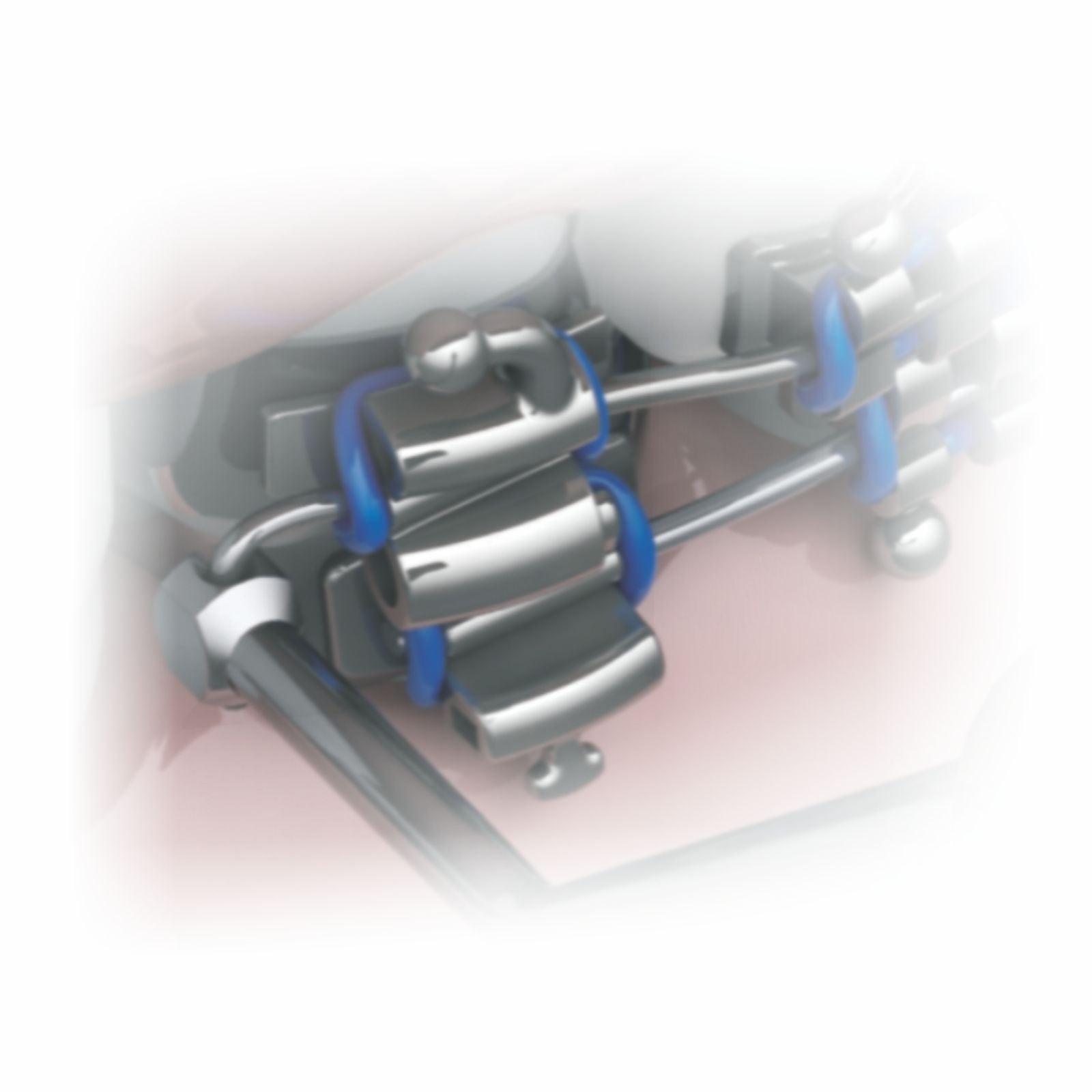 Arm Bending Distal & Ligature Bending