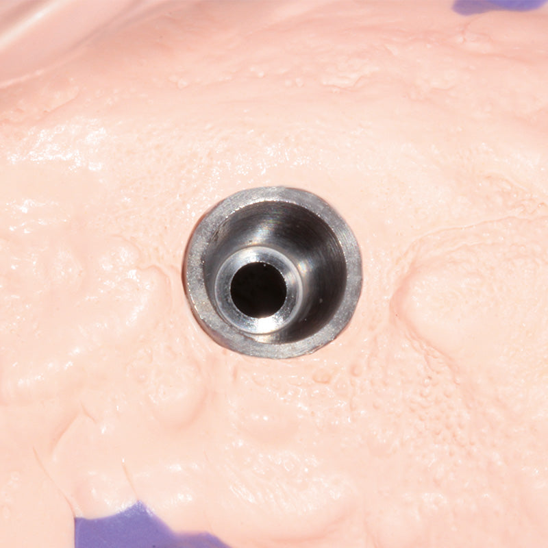 Hydrorise Implant Light Body – Scannable